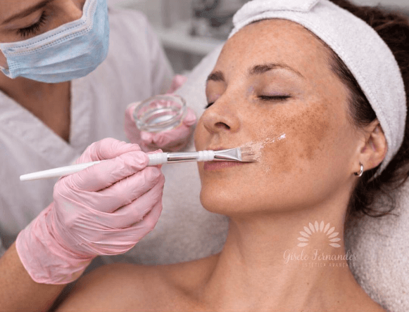 Combo Melasma
